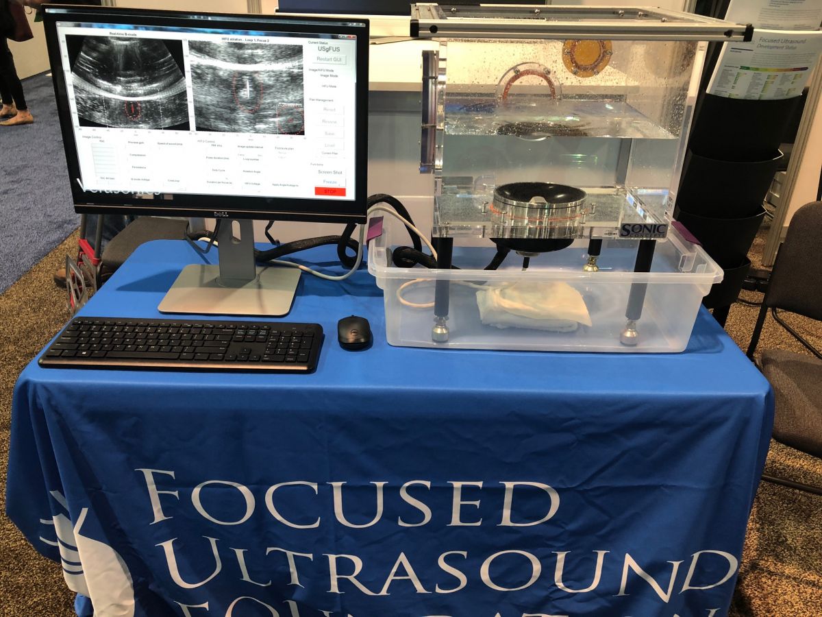 Photo Galleries - Focused Ultrasound Hong Kong Foundation Limited